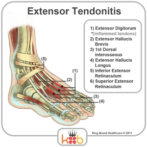 Ankle Extensor Tendons