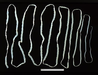 Human Intestine Length