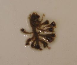 Human Parasites In Stool Pictures