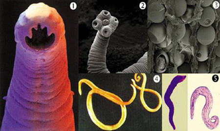 Internal Parasites In Humans Pictures