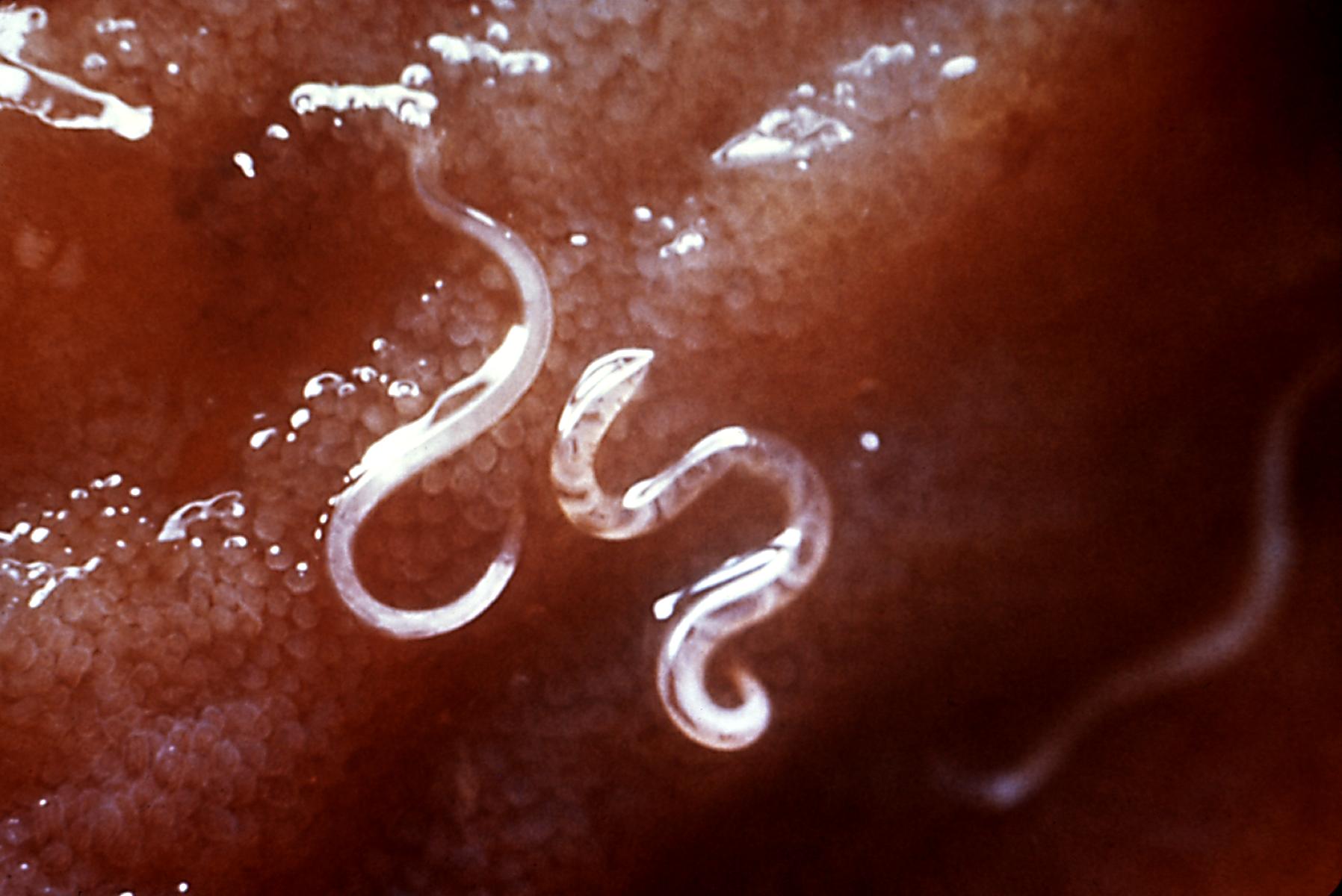Internal Parasites In Humans Pictures