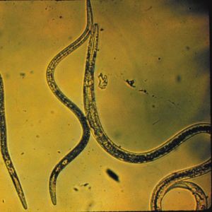 Intestinal Parasites In Humans Images