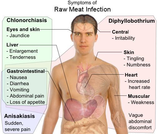 Intestinal Parasites In Humans Symptoms