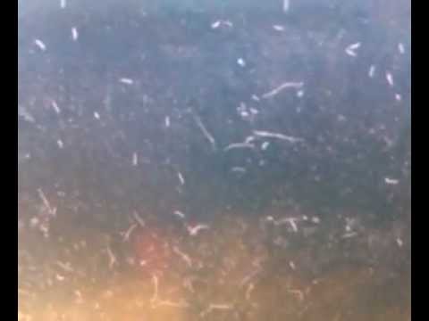 Little White Parasites In Fish Tank