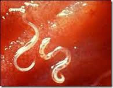 Lung Parasites In Humans Symptoms
