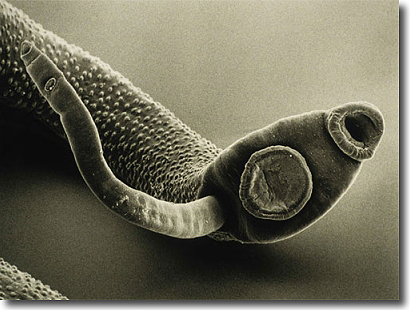 Parasites In Humans Symptoms Mayo Clinic