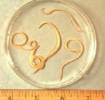 Parasites In Humans Symptoms Pictures