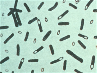 Picture Of Botulism Bacteria