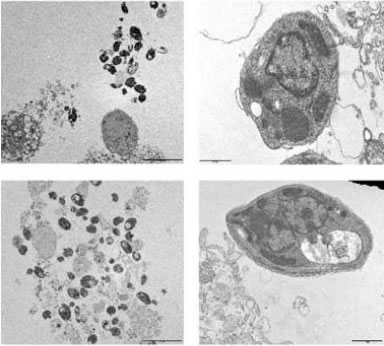 Pictures Of Parasites And Hosts