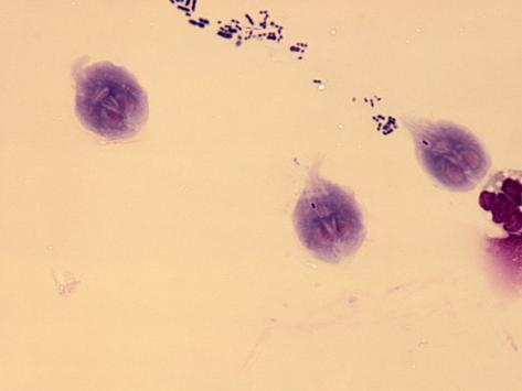 Protozoan Parasites In Humans