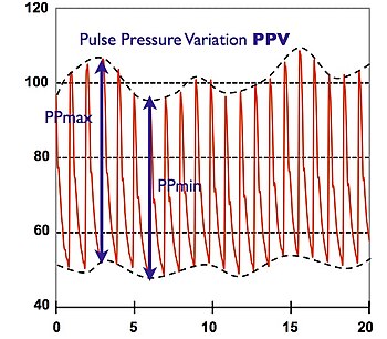 Pulse Wave Analysis Wiki