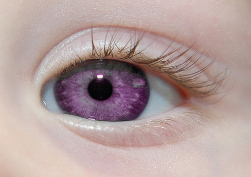 Purple Eyes Disease