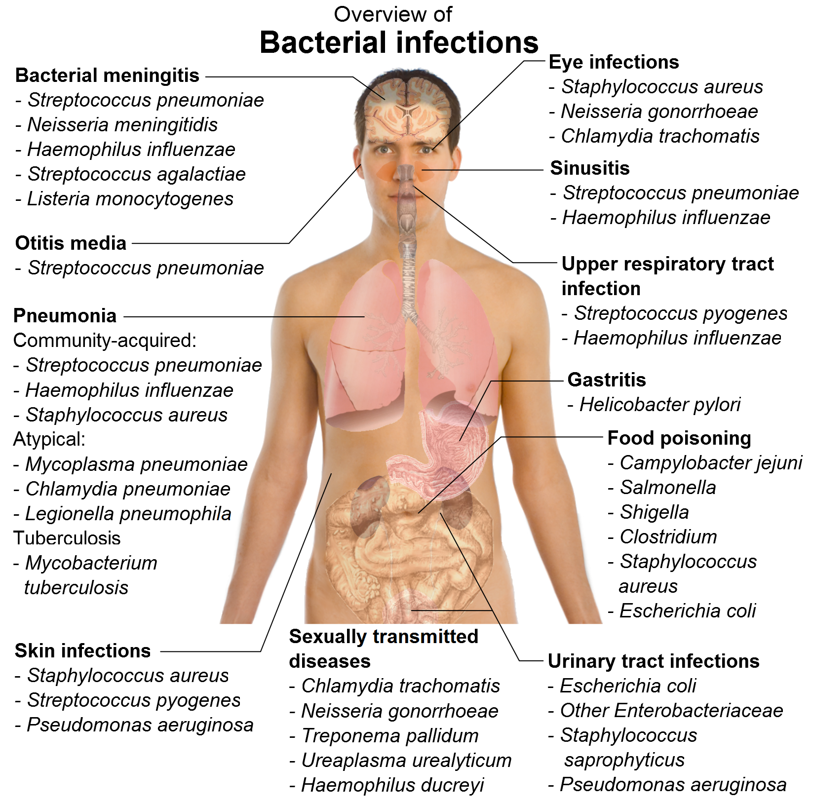 Septicemia Causes And Symptoms