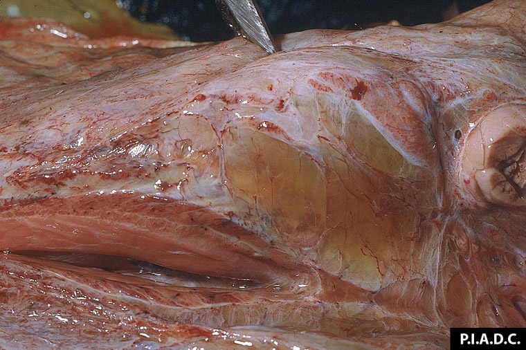 Septicemia Images