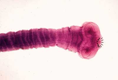 Worm Parasites In Humans