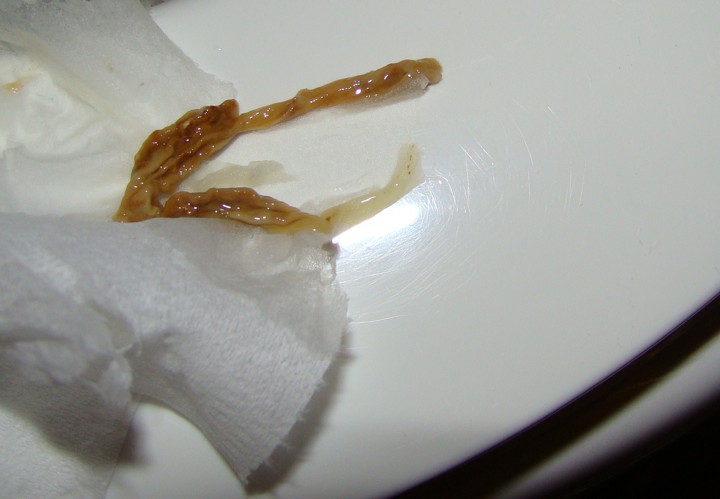 Worms Poop Human