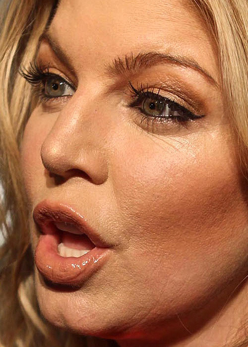 Fergie Teeth